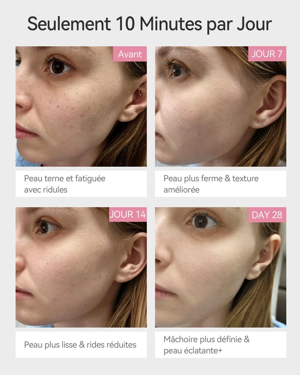 FliKEZE Gesichtsmassagegerät mit Vakuum & Rotlicht, 3-in-1 Beauty Gerät für Gesicht und Hals | Elektrisches Gesichtspflegegerät mit LED-Licht, 3 Intensitätsstufen und einfacher Anwendung für die tägliche Beauty-Routine