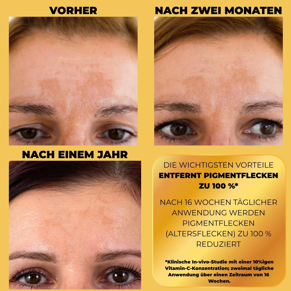 Afrodita Professional C10 Vitamin Super Shot Serum | 10% stabilisiertes Vitamin C Gesichtsserum gegen Pigmentflecken | Aufhellendes Anti-Aging Serum mit Glow-Effekt für alle Hauttypen 30 ml