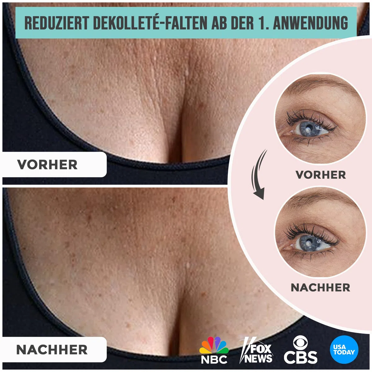 Antifalten Dekolleté Pads + GRATIS Augenpads | Dekoltee Pad, Stirn Pad & Augenpads zur Faltenreduktion | bis zu 30x Wiederverwendbar | 3in1 Set | I Anti Falten Pads & Anti Aging I 3 St.