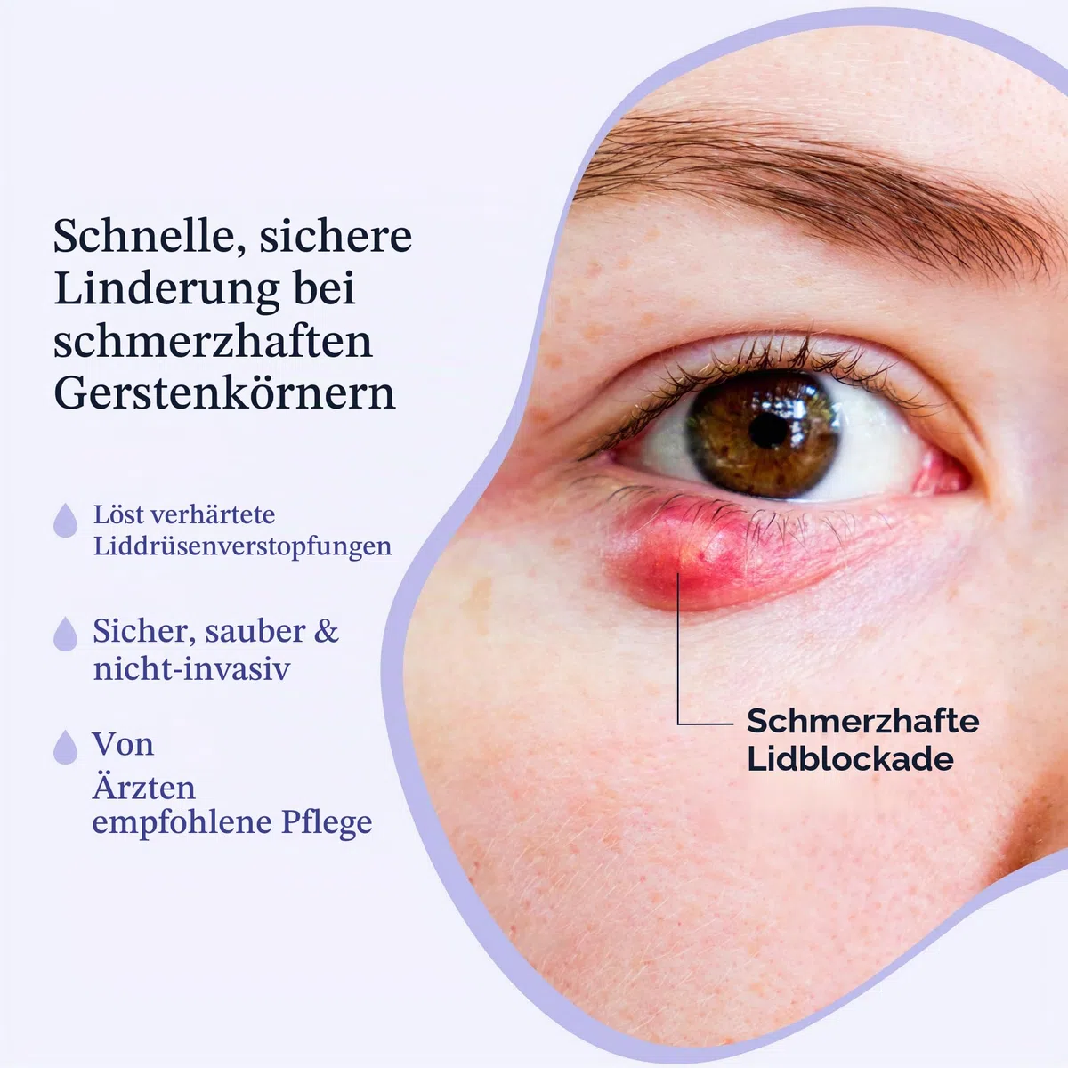 CorneaCare Ruhe: Selbsterwärmende warme Kompresse für trockene Augen, beheizte Augenmaske für schnelle Linderung, Dampfmaske zur Stilbehandlung, keine Mikrowelle oder Waschlappen erforderlich