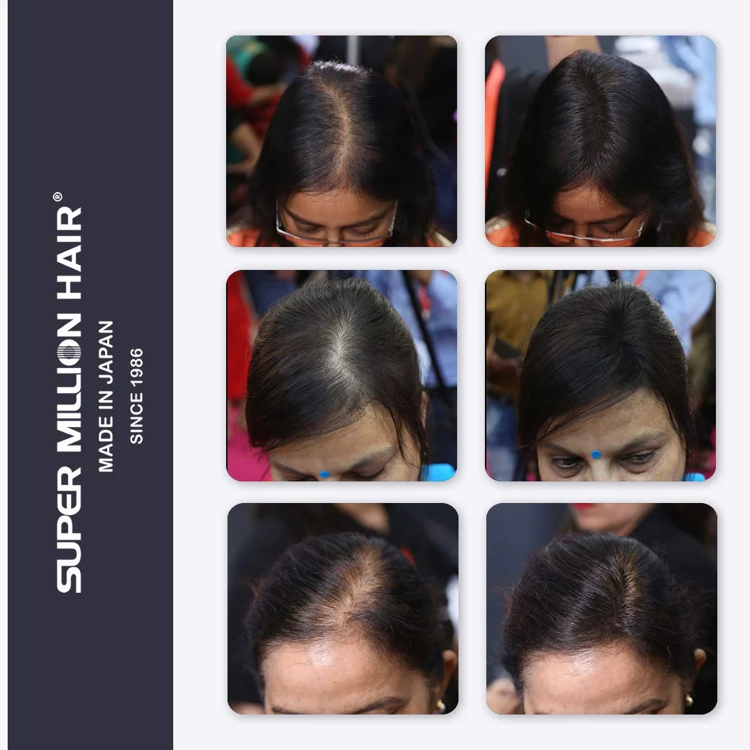 Super Million Hair 15g Hair Fibres - Medium Brown