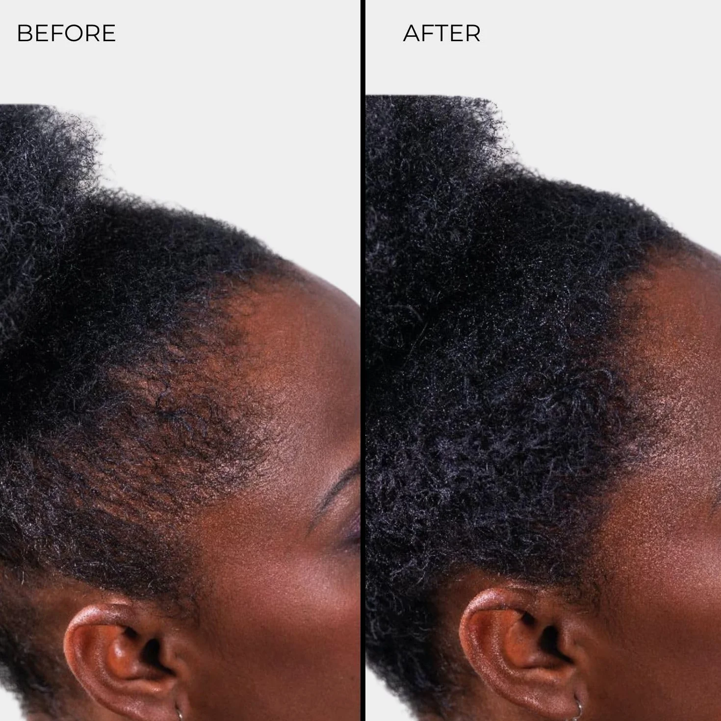 Nanogen Hair Thickening Fibres Black 30g