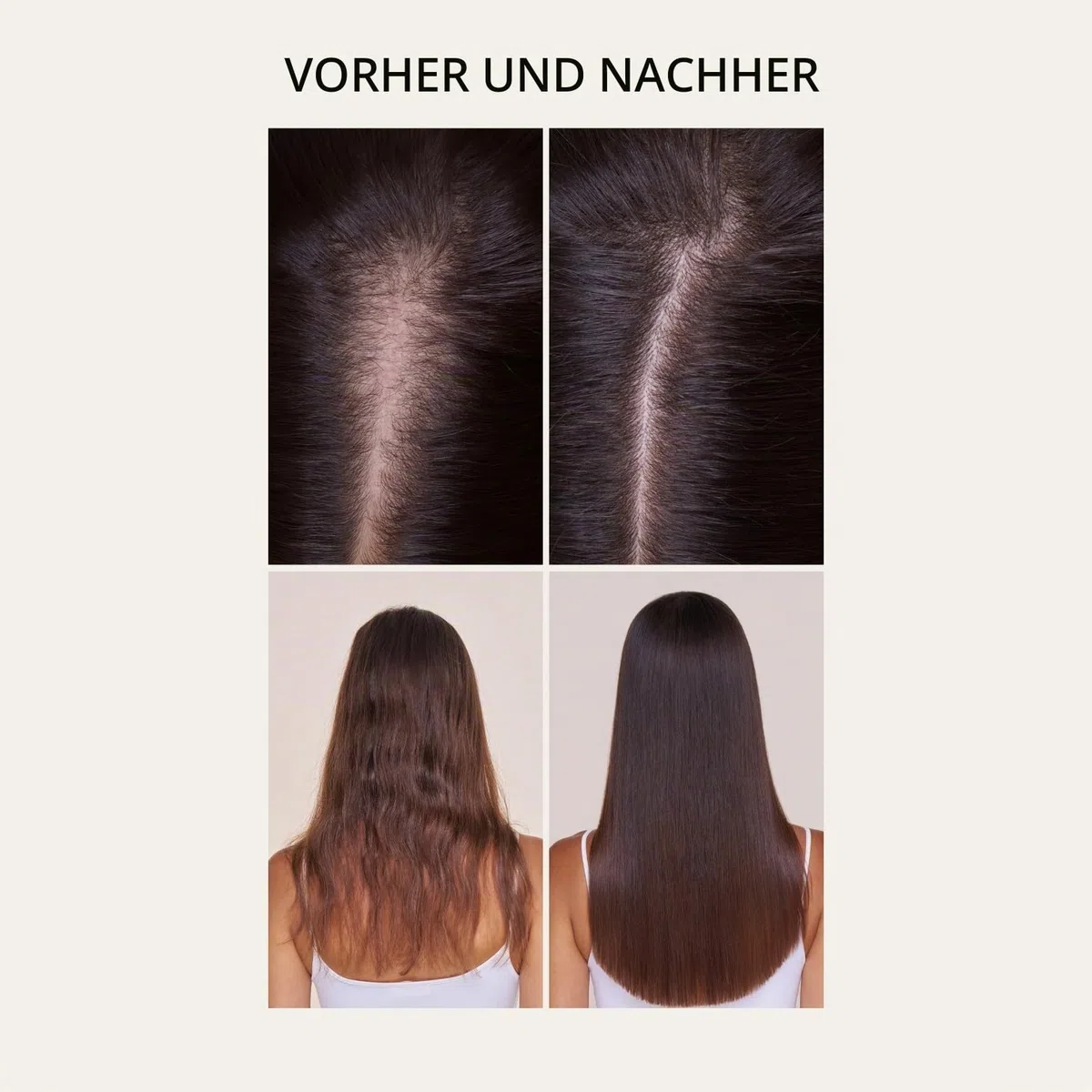 Forest & Shore Shampoo und Conditioner Set für Haarwachstum – Rosmarin Shampoo gegen Haarausfall mit Biotin, Koffein & Baicapil – 98% Natürlich, Sulfatfrei & ohne Silikone – Für Damen & Herren – 500ml