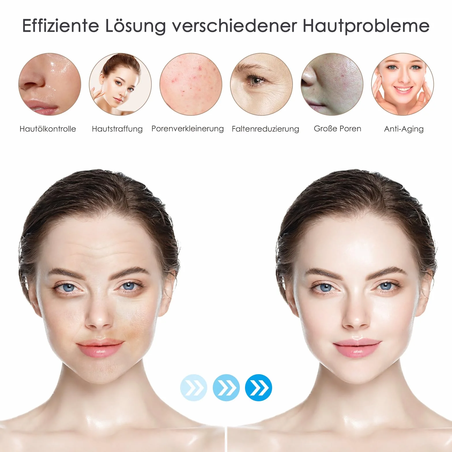 Dr. pen Ultima M8S Professionelle Microneedling Pen – Drahtlos, LED-Anzeige, 0-2,5 mm verstellbar, 7 sterile Ersatzpatronen