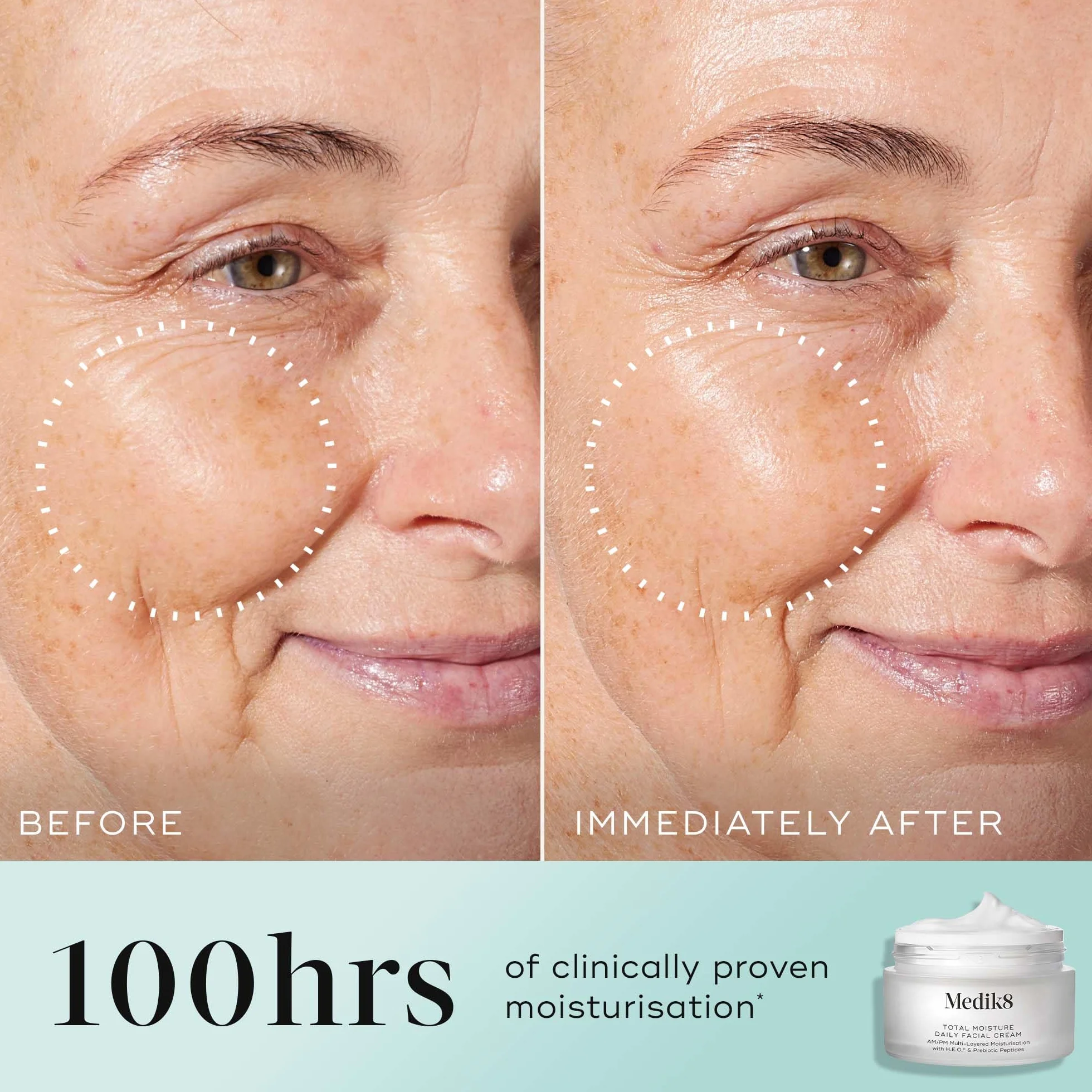 Medik8 Total Moisture Daily Facial Cream Refill Pod Hyaluronsäure Feuchtigkeitscreme, Tag und Nacht Gesichtscreme, klinisch erwiesene sofortige & dauerhafte Feuchtigkeitspflege - parfümfrei - 50 ml