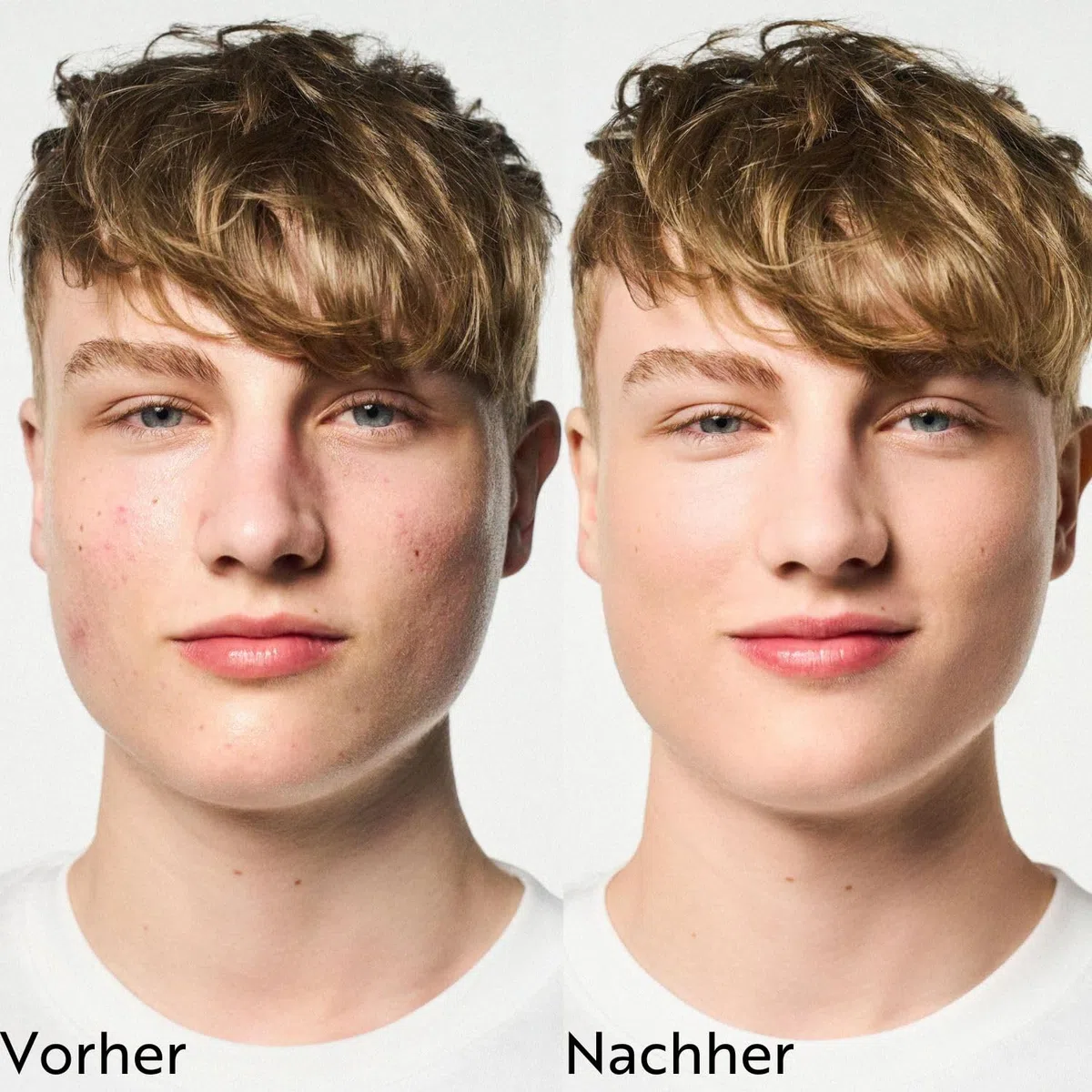 M. Asam CLEAR SKIN Set 4-teilig Anti Pickel Pflege reine Haut Waschgel Toner Maske Creme Porenreiniger Gesichtspflege