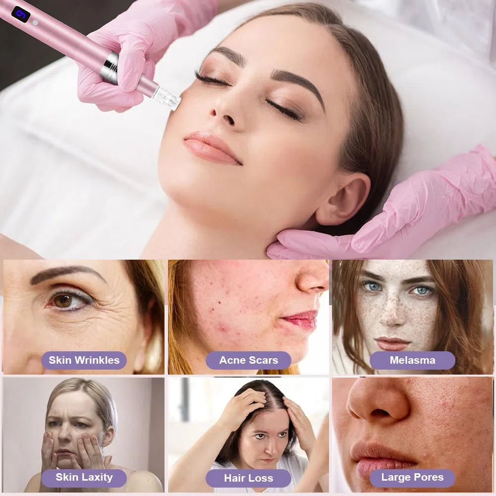 Vicloon Elektrisch Microneedling Pen, Drahtloser Elektrischer Dermapen Mikroneedling mit LCD Bildschirm und 5 Stufen, Einstellbar 0-2,5mm, Microneedle Haut Reparatur Tool (inkl.12 Nadelköpfe)-Rosa