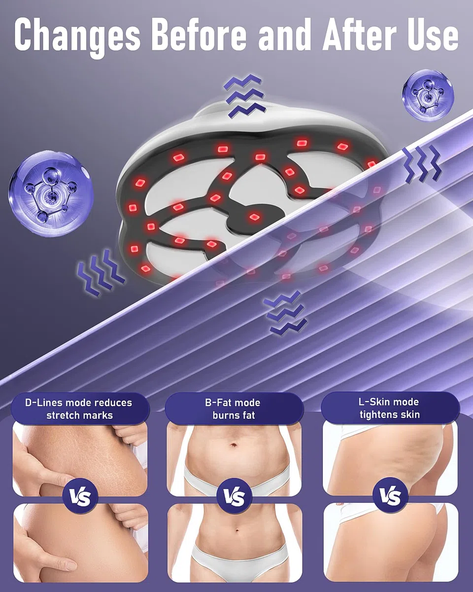 Cellulite Massager, 15 Adjustable Levels, 3 Working Modes
