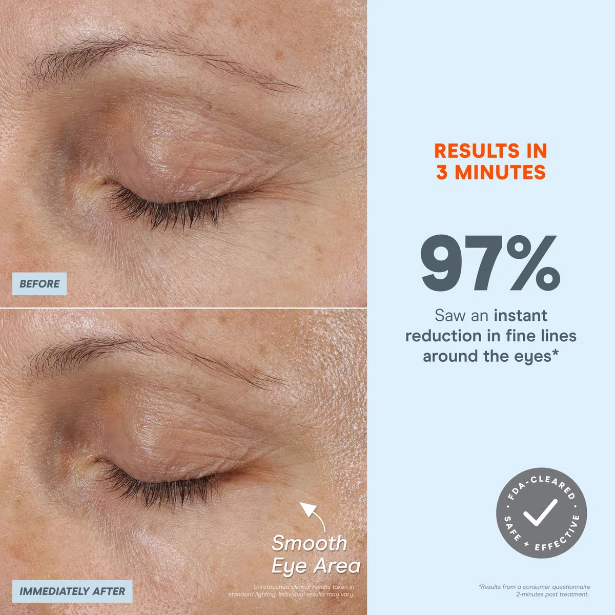 NuFACE FIX MicroWand - Microcurrent Device + Serum Activator for On-The-Go Treatment of Forehead Lines, Crow's Feet, Under Eyes, Smile Lines & Fuller-Looking Lips