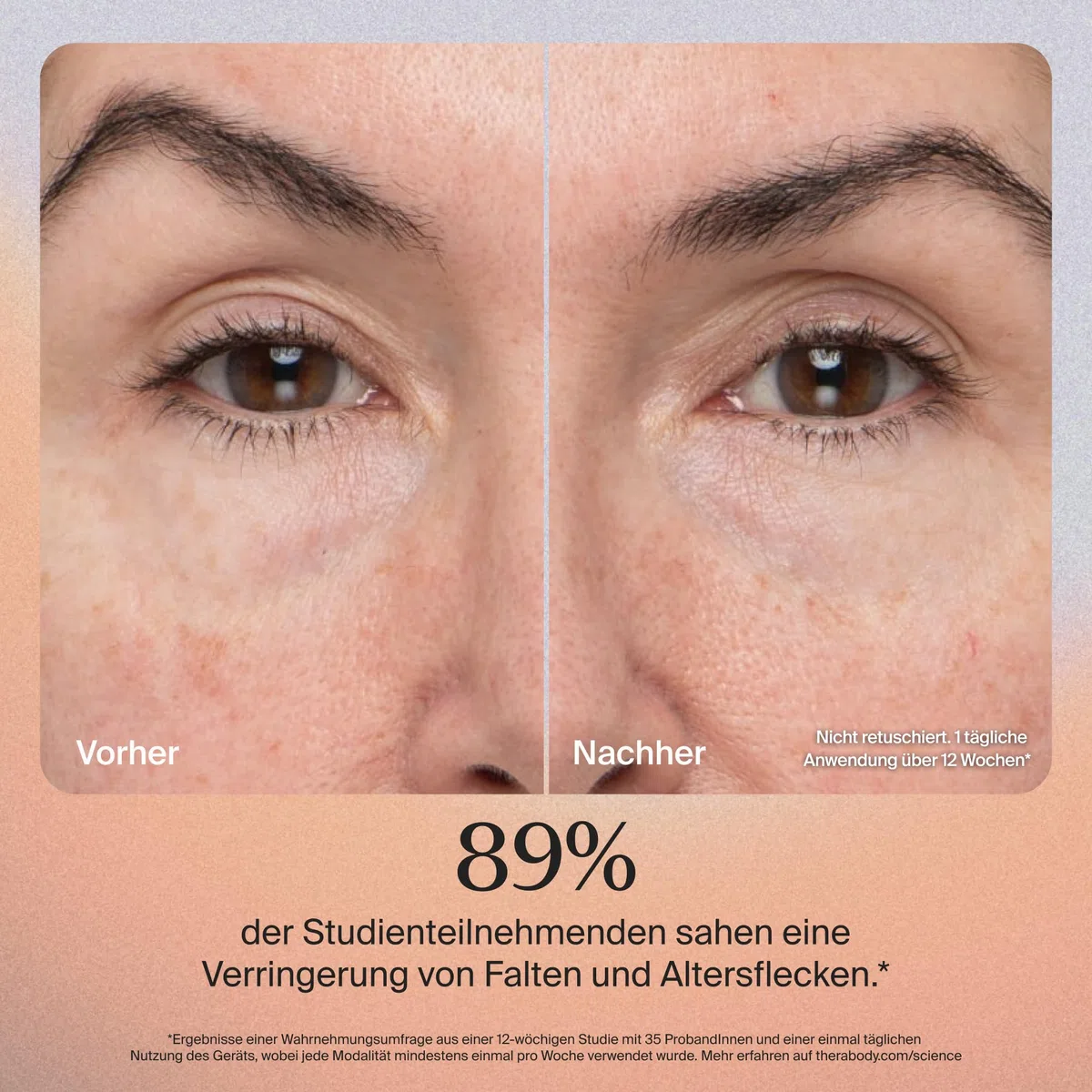 TheraFace PRO | 6-IN-1 Gesichtspflege perkussive Therapiemassage - Mikrostrom - Blaue & Rote LED von Therabody (Weiß)