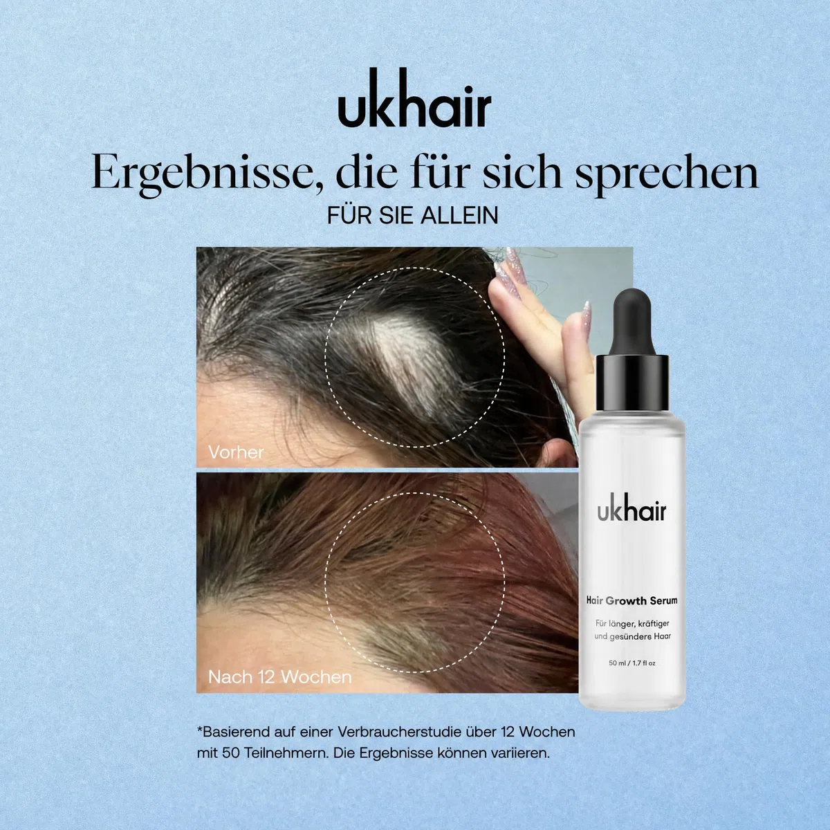 UKLASH Haarrevitalisierendes Serum für Männer und Frauen, fördert die Dicke bei dünnerem Haar und Haarausfall, klinisch getestet, leicht und schnell saugfähig