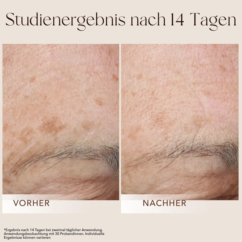 mellow NOIR XTREME Brightening Booster 30ml - Anti Pigmentflecken Serum - Reduziert dunkle Flecken, Altersflecken & Pickelmale im Gesicht und auf der Haut - Vegan - Zertifizierte Naturkosmetik